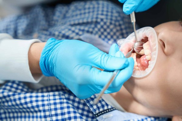 Comment prévenir les caries à LaSalle ?